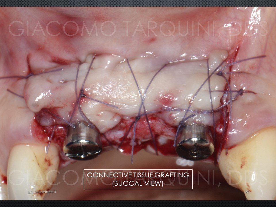 Diapositiva24.JPG.a683549c0de4e547e87ad0c10d4304c9.JPG