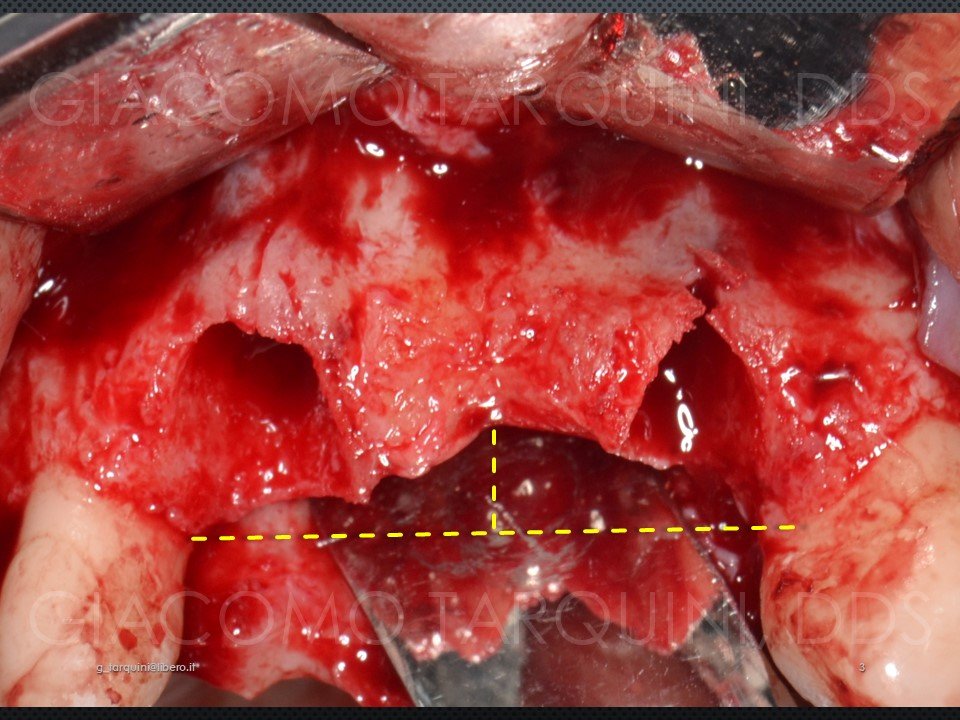 Diapositiva3.JPG.24a7bc245c3b1423d331d266ce424259.JPG