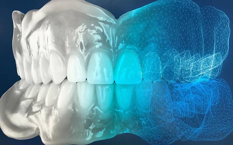 Corso (Teorico Pratico) Clinico Tecnico di Protesi Totale Digitale E Protesi Totale Semplificata I Ed. 2025